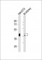 (Mouse) Bmi1 Antibody (Center)